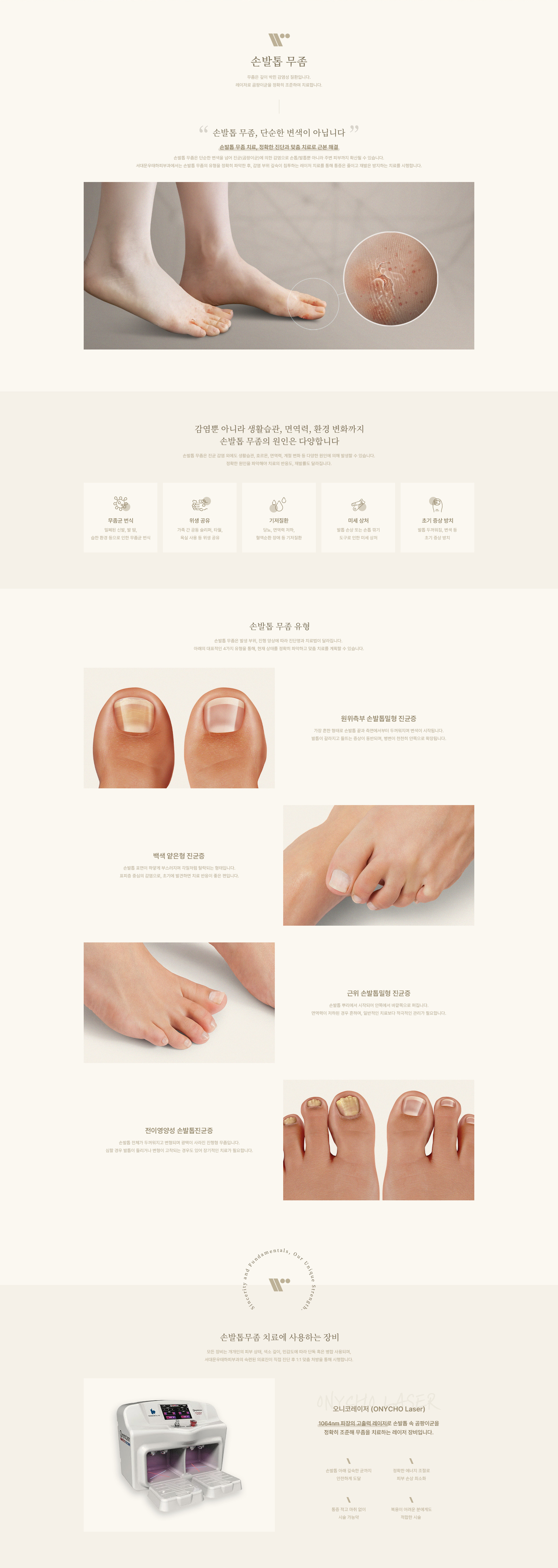 손발톱 무좀