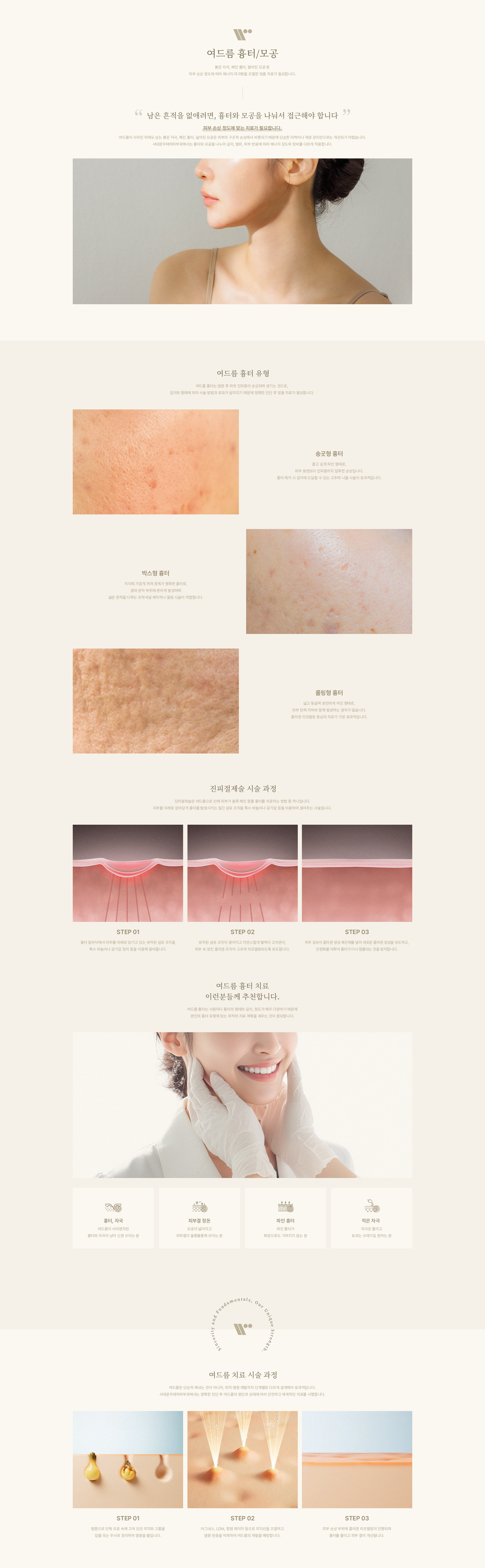 여드름 흉터, 모공